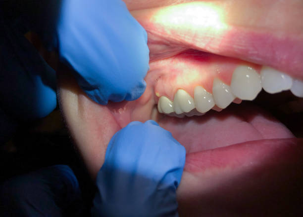 Best Pediatric Emergency Dentist in Crossville, TN