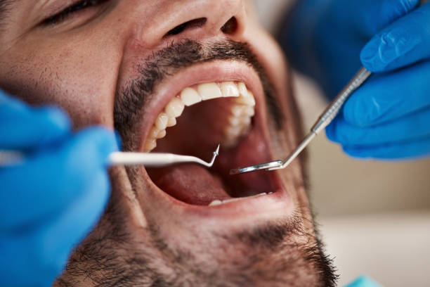 Best Emergency Dental Care for Broken or Chipped Teeth in Crossville, TN